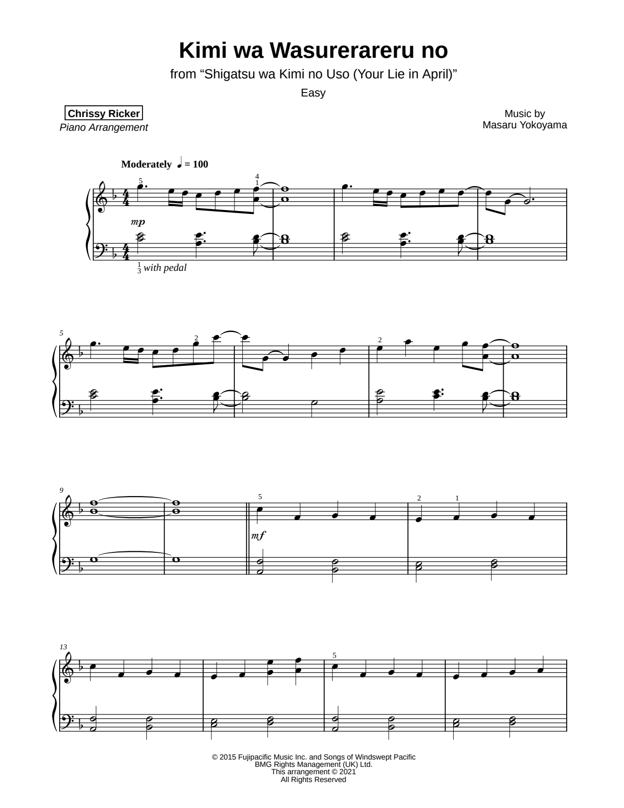 Kimi wa Wasurerareru no [easy]